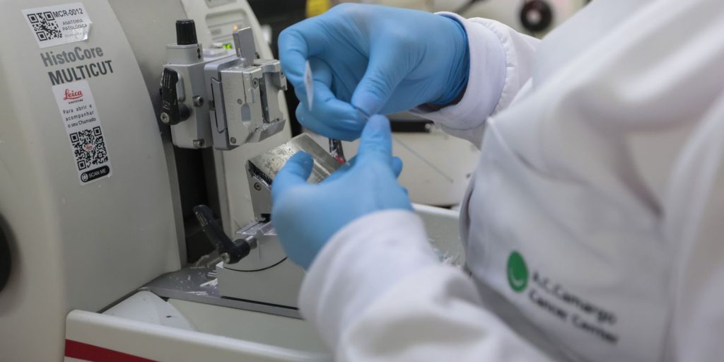 Cura de câncer de próstata pode chegar a 98%, diz especialista